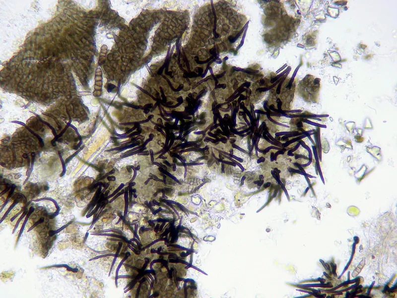 Capronia chlorospora 12 - x 400-001